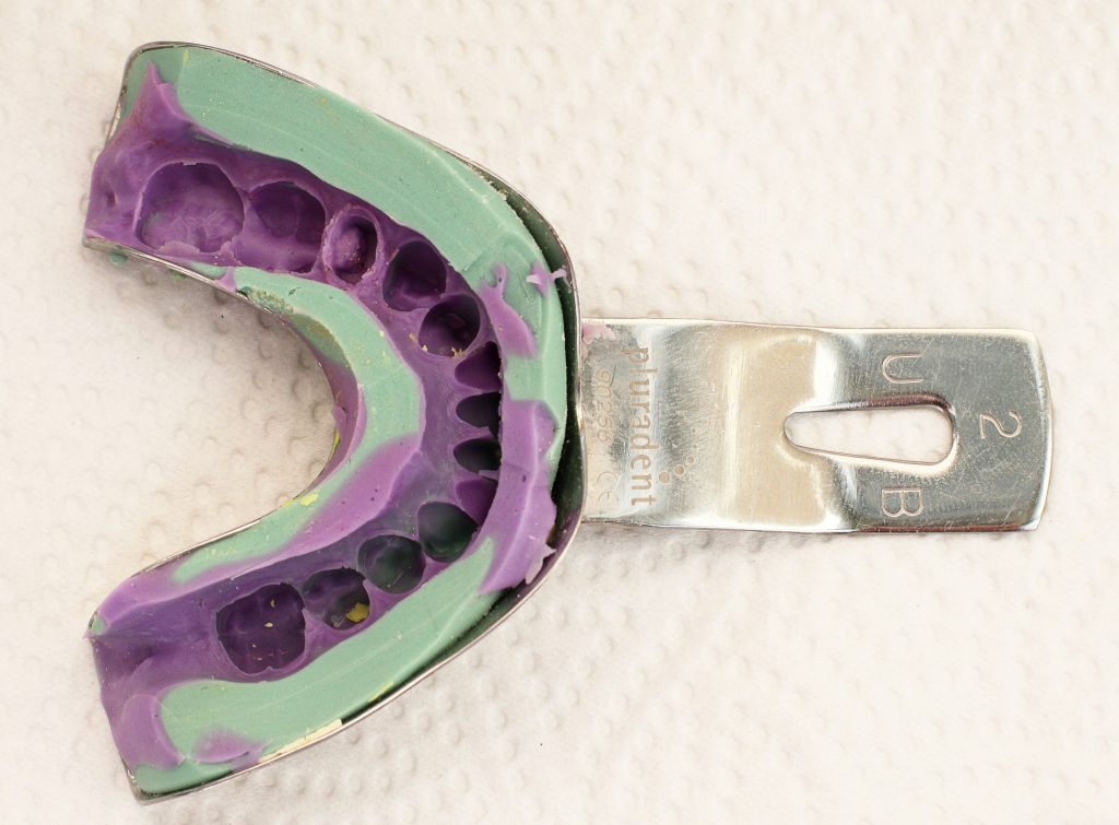 Aplicaciones dentales – Industrias Roko